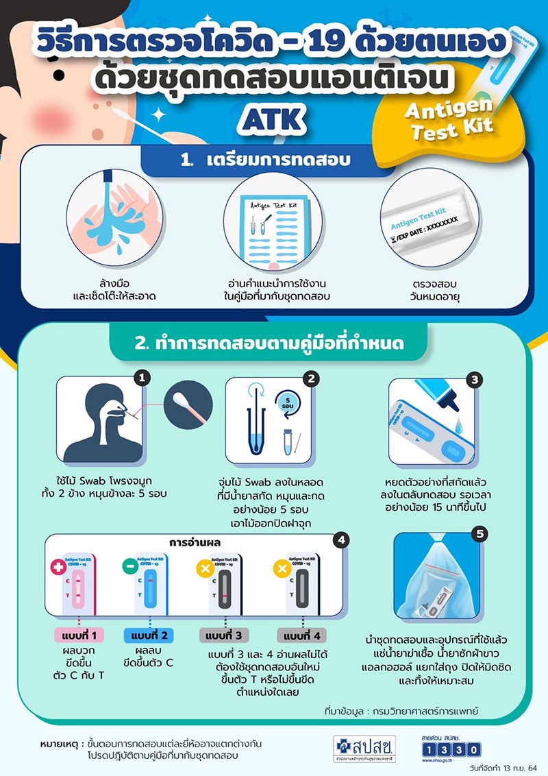 ATK ขึ้น 2 ขีดจาง ๆ หลังทิ้งไว้นาน ติดหรือไม่ติด